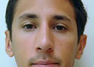 rhinoplasty-plastic-surgery-nose-job-inland-empire-man-after-front-dr-maan-kattash2